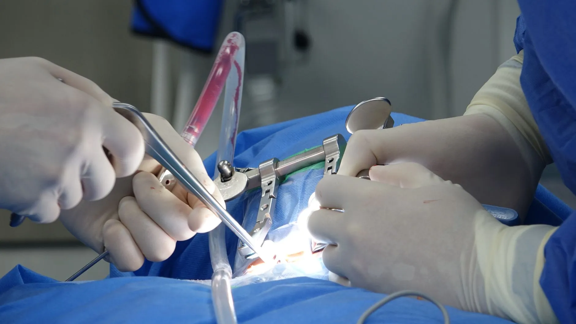 滦南县居家照护服务解析：心贴心智慧养老如何实现全流程健康管理